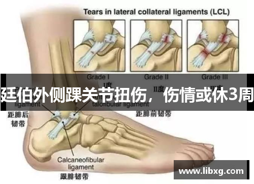 廷伯外侧踝关节扭伤，伤情或休3周